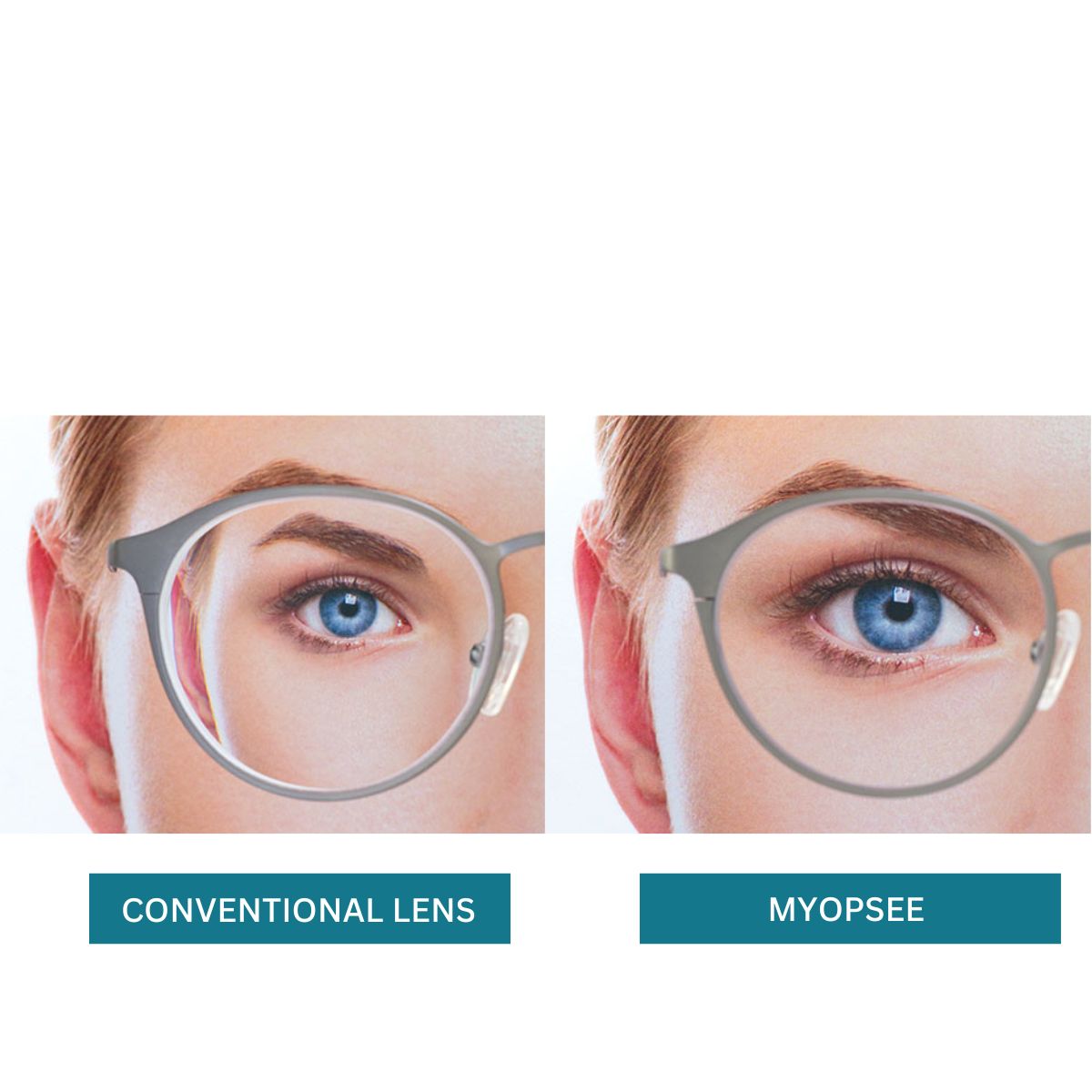Nikon Myopsee DAS Single Vision Lens